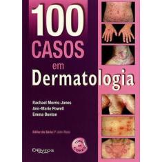 100 Casos em Dermatologia - DI LIVROS