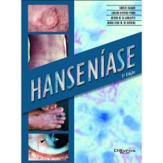 Hanseniase