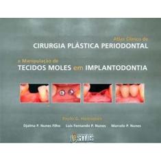 Livro - Atlas Clínico De Cirurgia Plástica Periodontal