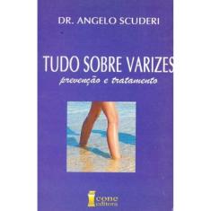 Tudo Sobre Varizes - Prevenção e Tratamento