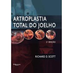 Artroplastia Total Do Joelho