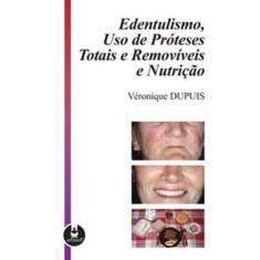 Edentulismo, Uso De Proteses Totais e Removiveis