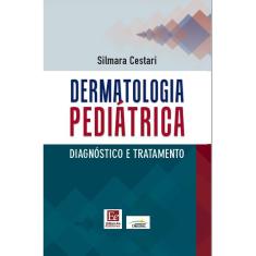 Livro - Dermatologia pediátrica: Diagnóstico e tratamento