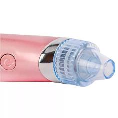 Removedor de Cravos e Espinhas Portátil à Vácuo - Pilhas Incluídas