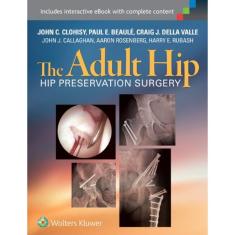 The Adult Hip : Hip Preservation Surgery