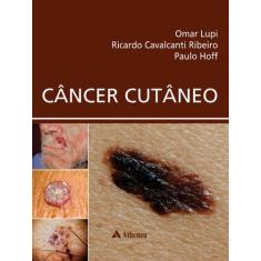 Livro - Câncer Cutâneo