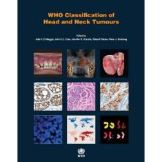 Who Classification Of Head And Neck Tumours