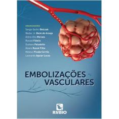 Embolizacoes Vasculares - Livraria E Editora Rubio Ltda