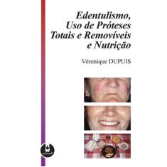 Livro - Edentulismo, Uso de Próteses Totais e Removíveis e Nutrição