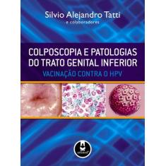 Livro - Colposcopia e Patologias do Trato Genital Inferior