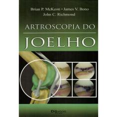 Artroscopia Do Joelho