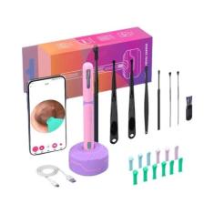Conjunto De Limpeza De Ouvido HD Com Câmera USB C Otoscópio Ferramenta