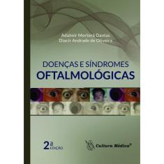 Livro - Doenças E Síndromes Oftalmológicas – 2. Ed -de Oliveir