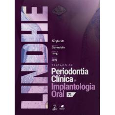 Livro - Tratado de Periodontia Clinica e Implantologia Oral