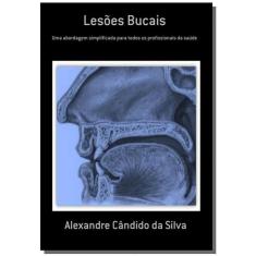 Lesoes Bucais