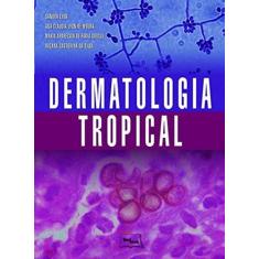 Dermatologia Tropical