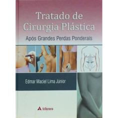 Livro - Tratado de cirurgia plástica após grandes perdas ponderais