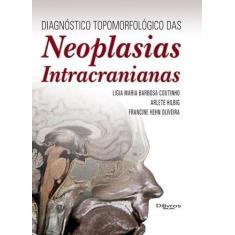 NEOPLASIAS INTRACRANIANAS, Autor: LIGIA MARIA BARBOSA COUTINHO ARLETE 