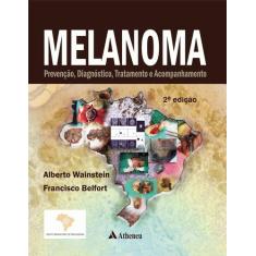 Livro - Melanoma - prevenção, diagnóstico, tratamento e acompanhamento