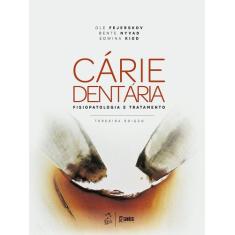 Livro - Cárie dentária: fisiopatologia e tratamento