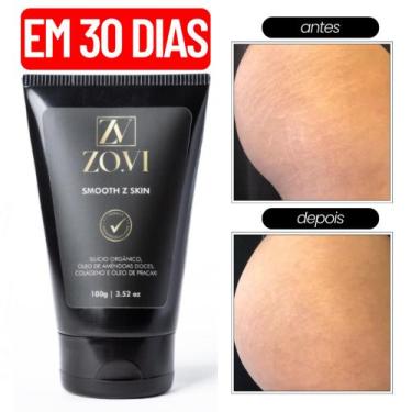 Imagem de Creme para Estrias e Celulites Hidratação Intensa e Cuidado com a Pele