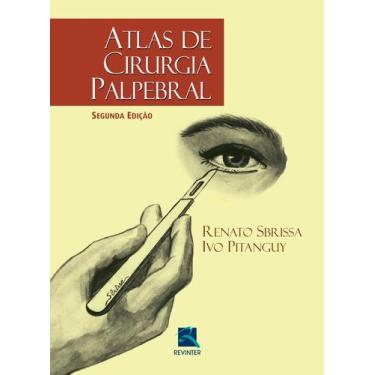 Imagem de Livro - Atlas de Cirurgia Palpebral