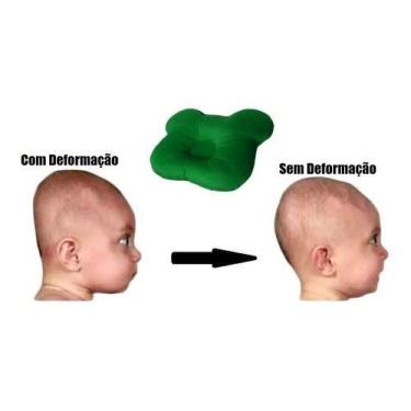 Imagem de Travesseiro Plagiocefalia Cabeça Amassada Do Bebê - Happy Line, Verde