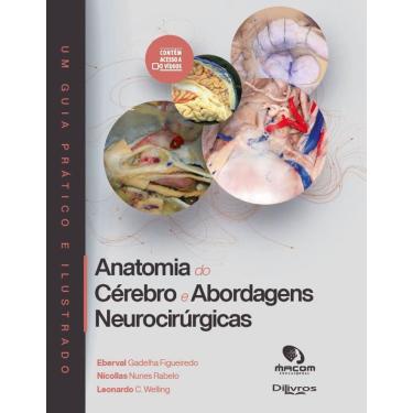 Imagem de Anatomia Do Cerebro E Abordagens Neurocirurgicas