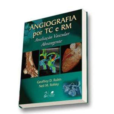 Imagem de Angiografia Por Tc E Rm - Avaliacao Vascular Abrangente