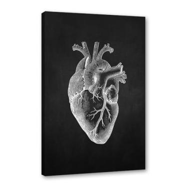 Imagem de Fundo preto anatomia humana arte médica impressões em tela imagens esqueleto músculo pôster vintage educação pintura arte decoração de parede (SKU14,27.9x35.6 cm = (28x35 cm), emoldurado (tela