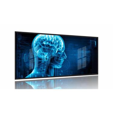 Imagem de Quadro  Consultório Médico Neurologia Decorativo 130x60 Moldura Preta 2x2