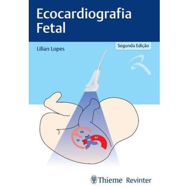 Imagem de Ecocardiografia Fetal, Autor: Lopes, Lilian - LIVRARIA E EDITORA REVIN