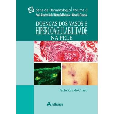 Imagem de Doencas Dos Vasos E Hipercoabilidade Na Pele - Vol.3 - Serie: Dermatologica