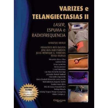 Imagem de Livro Varizes E Telangiectasias IiLivroLaser, Espuma E Radiofrequencia