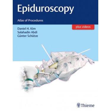 Imagem de Epiduroscopy - Thieme Publishers Inc/maple Press