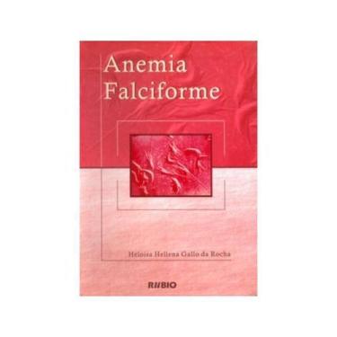 Imagem de ***Anemia Falciforme*** -   - LIVRARIA E EDITORA RUBIO LTDA