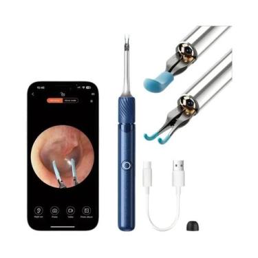 Imagem de Pinça De Ouvido 3 Em 1 Com Wi-Fi E Câmera De 12MP, Ferramenta De Remoç