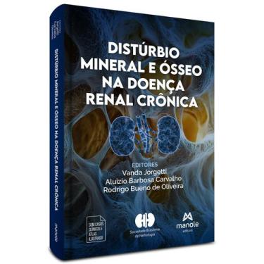 Imagem de Livro - Distúrbio mineral e ósseo na doença renal crônica