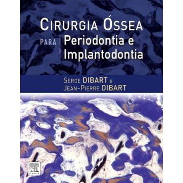 Imagem de Livro - Cirurgia óssea para periodontia e implantodontia