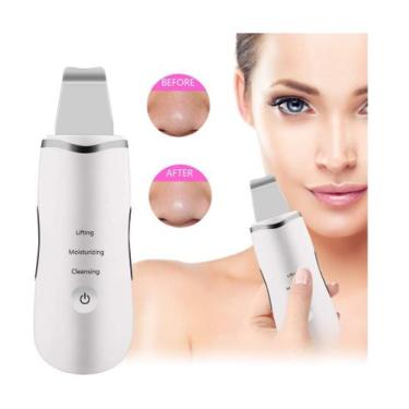 Imagem de Espatula Limpeza Facial Rejuvenesce e Elimina celulas Mortas Cravo Acn