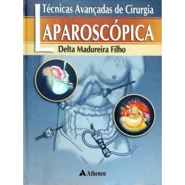 Imagem de Livro - Técnicas avançadas de cirurgia laparoscópica