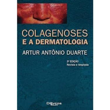 Imagem de Colagenoses e a dermatologia - NoBrand