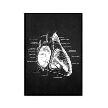 Imagem de Fundo preto anatomia humana arte médica impressões em tela imagens músculo esqueleto vintage pôster educação pintura arte decoração de parede (SKU13,40.6x61.0 cm = (40x60cm), moldura preta para fotos)