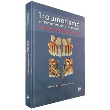 Imagem de Livro Traumatismo Em Dentes Decíduos E Permanentes, 1ª Ed - Santos