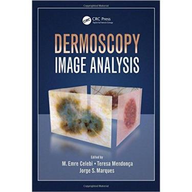 Imagem de Dermoscopy Image Analysis