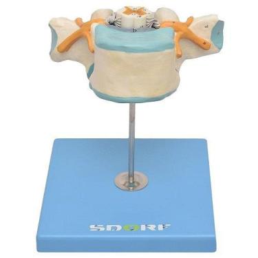 Imagem de Vértebra Torácica C/ Cordão Espinhal Modelo Anatomia