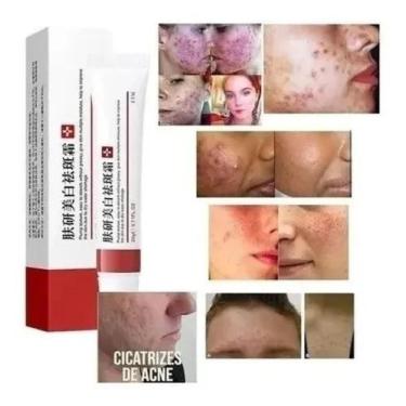 Imagem de Creme Clareador Melasma Manchas Sardas 20g Ebg - Ebug