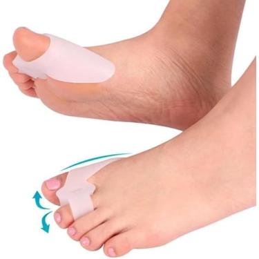 Imagem de Protetor de Joanetes em Silicone – Separador de Dedos e Alívio de Atrito | Macio, Hipoalérgico e Reutilizável | Conforto para Caminhar com Sapatos e Tênis – 1 Par (2 Unidades)
