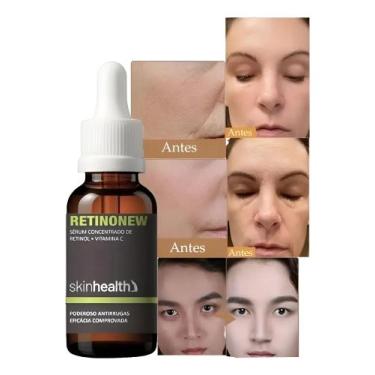 Imagem de Serum Antissinais Clareador Retinol Vitamina C 30ml Sh. - Skinhealth