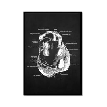 Imagem de Fundo preto anatomia humana arte médica impressões em tela imagens esqueleto músculo pôster vintage educação pintura arte decoração de parede (SKU11,30.5x45.7 cm = (30x45cm), moldura de metal preto)